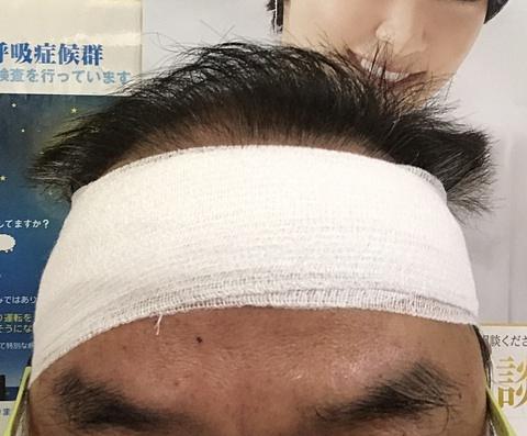 サンシャイン池崎ではない→