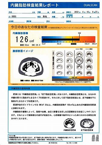内臓脂肪検査結果レポート