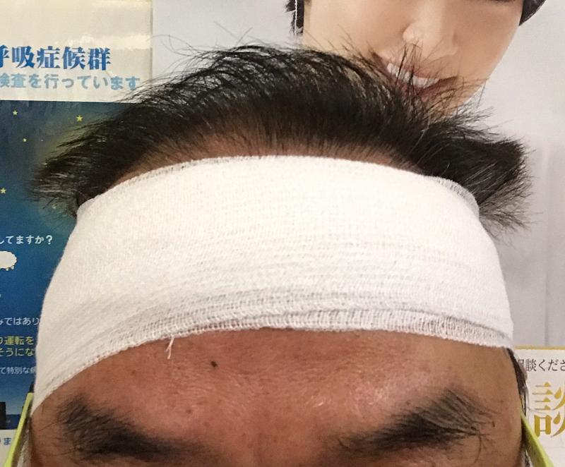 エライことになりました