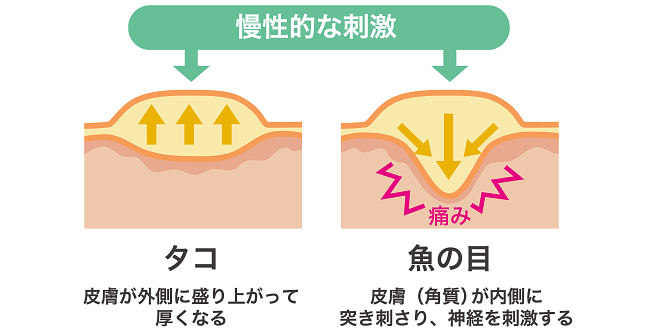 タコと魚の目の違い